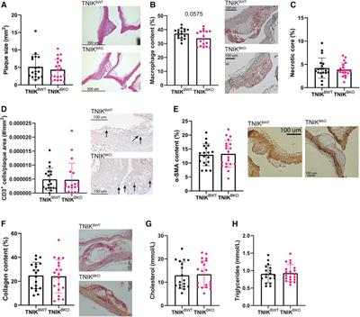 Deficiency of germinal center kinase TRAF2 and NCK-interacting kinase (TNIK) in B cells does not affect atherosclerosis